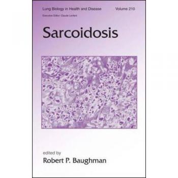 Sarcoidosis: 210