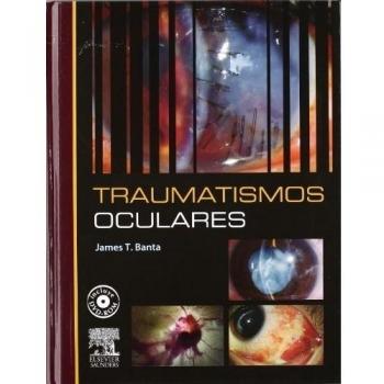 Traumatismos oculares + DVD-ROM