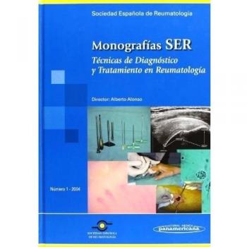 Monografias ser