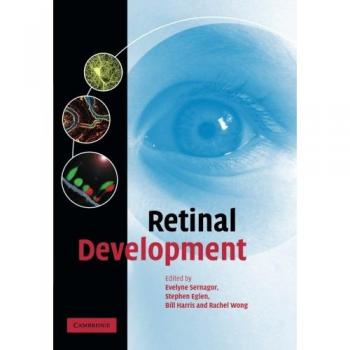 Desarrollo Retinal PB Cambridge