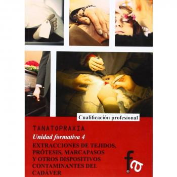 Extracciones De Tejidos