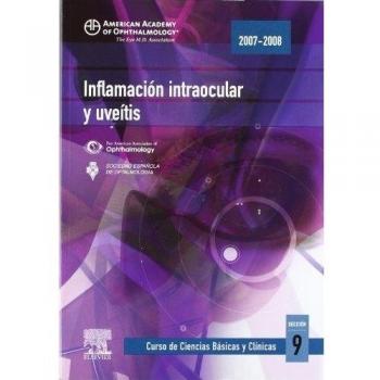 Inflamación intraocular y uveítis