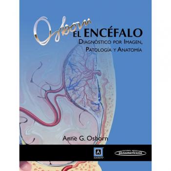 El encefalo: Diagnóstico por imagen, patología y anatomía