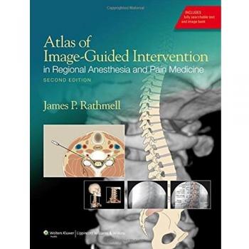 Image-Guided Intervention Atlas for Regional Anesthesia and Pain Management, 2nd Edition by Rathmell