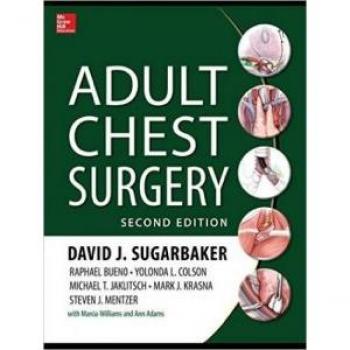 Comprehensive Guide to Adult Chest Surgery