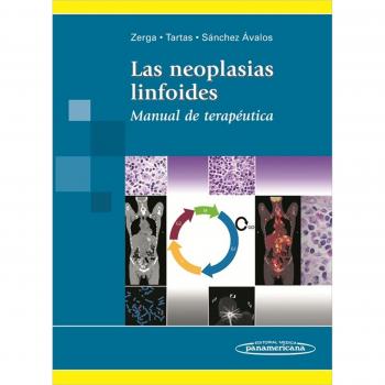 Las neoplasias linfoides: Manual de terapéutica + Compendio de terapéutica