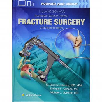 Harborview Illustrated Tips and Tricks in Fracture Surgery