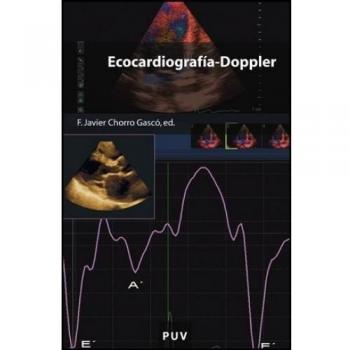 Ecocardiografía-Doppler: 114