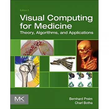 Visual Computing for Medicine: Theory, Algorithms, and Applications