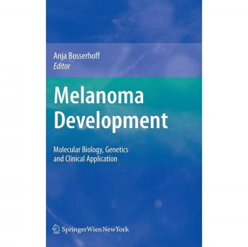 Melanoma Development