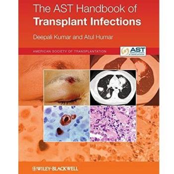 Transplant Infection Management Guide by Deepali Kumar