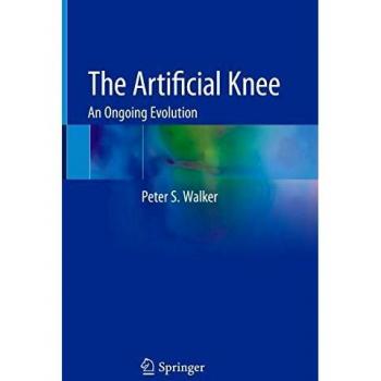 The Artificial Knee: An Ongoing Evolution