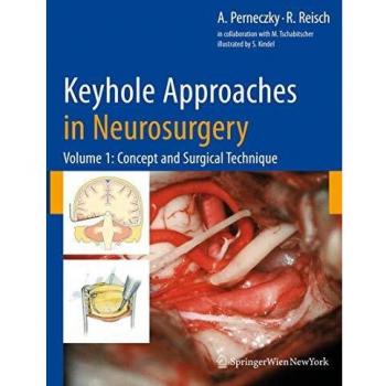 Keyhole Approaches in Neurosurgery: Volume 1: Concept and Surgical Technique