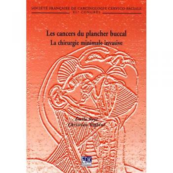 Les cancers du plancher buccal : La chirurgie minimale invasive