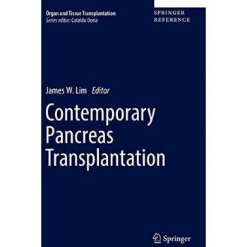 Contemporary Pancreas Transplantation