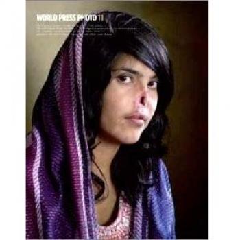 World Press Photo 2011