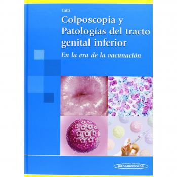Colposcopia y Patologías del tracto genital inferior: En la era de la vacunación