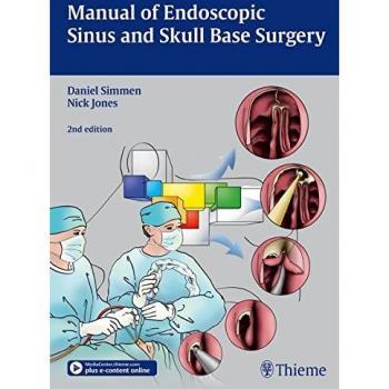 Endoscopic Sinus and Skull Base Surgery Manual: Comprehensive Guide with Extended Applications