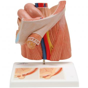 3B Scientific H13 Modelo de anatomía humana Modelo de Hernia Inguinal + software de anatomía gratuito - 3B Smart Anatomy