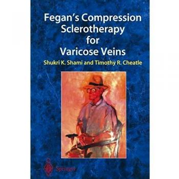 Fegan's Compression Sclerotherapy for Varicose Veins