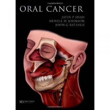 Oral Cancer