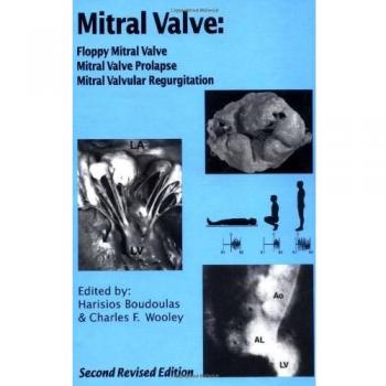 Mitral Valve: Floppy Mitral Valve, Mitral Valve Prolapse, Mitral Valvular Regurgitation