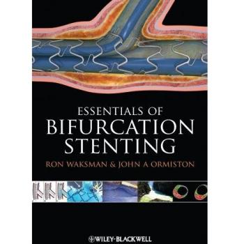 Bifurcation Stenting