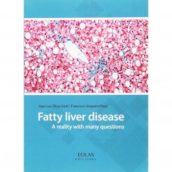 FATTY LIVER DISEASE: A REALITY WITH MANY QUESTIONS - OLCOZ JOSE LUIS