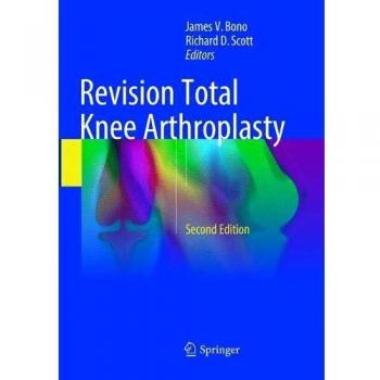 Revision Total Knee Arthroplasty