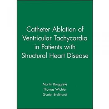 Catheter Ablation of Ventricular Tachycardia in Patients with Structural Heart Disease