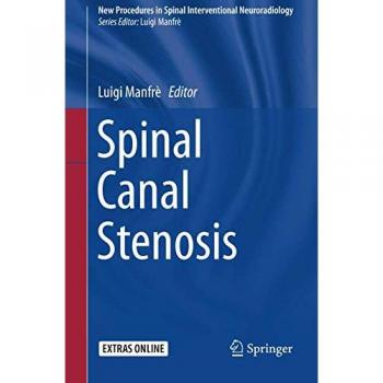 Spinal Canal Stenosis