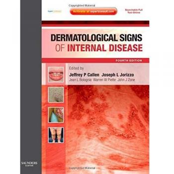 Dermatological Signs of Internal Disease: Expert Consult - Online and Print, 4e