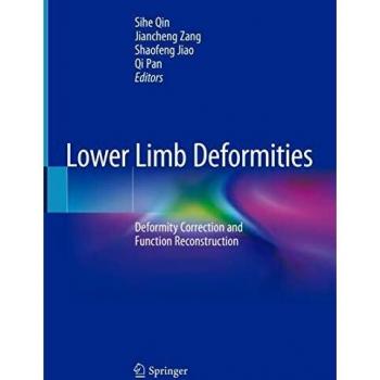 Lower Limb Deformities: Deformity Correction and Function Reconstruction