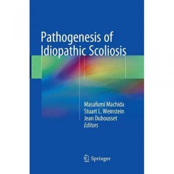 Pathogenesis of Idiopathic Scoliosis