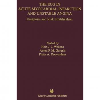 ECG Analysis for Acute Myocardial Infarction and Unstable Angina: Diagnosis and Risk Assessment Guide