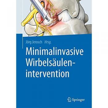 Minimalinvasive Wirbelsäulenintervention