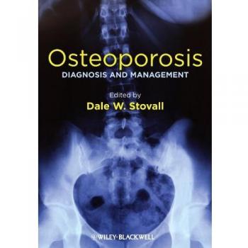 Osteoporosis: Diagnosis and Management
