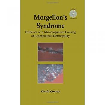 Morgellon's Syndrome