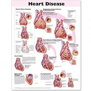 Heart Disease Anatomical Chart