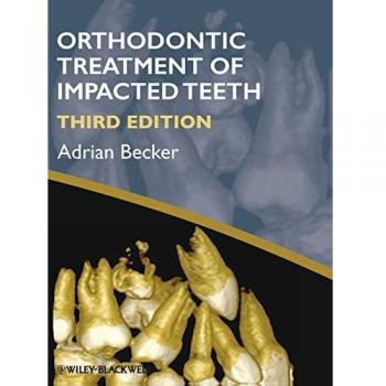Orthodontic Treatment of Impac