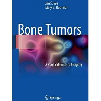Springer Bone Tumor Guide: Comprehensive Resource for Bone Tumors