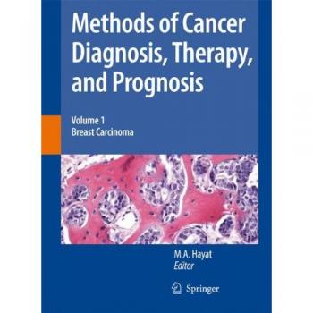 Methods of Cancer Diagnosis, Therapy and Prognosis: Breast Carcinoma: 1