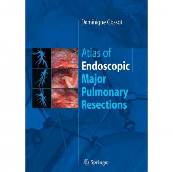 Atlas of endoscopic major pulmonary resections