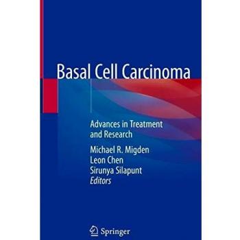 Basal Cell Carcinoma: Advances in Treatment and Research