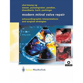 Modern Mitral Valve Repair: Echocardiographic Interpretations and Surgical Strategies