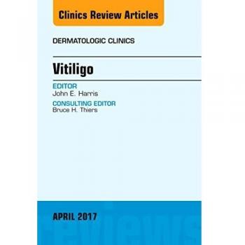 Vitiligo, An Issue of Dermatologic Clinics, 1e: Volume 35-2