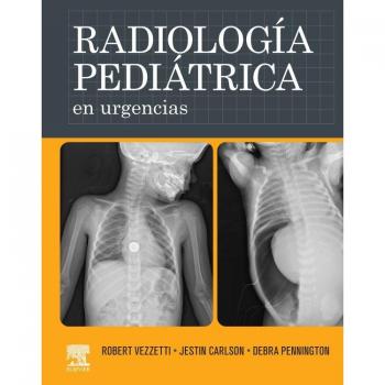 Radiología pediátrica en urgencias