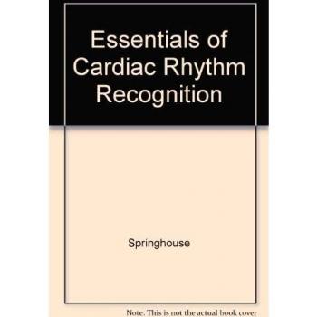 Essentials of Cardiac Rhythm Recognition