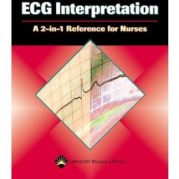 ECG Interpretation: A 2-in-1 Reference for Nurses