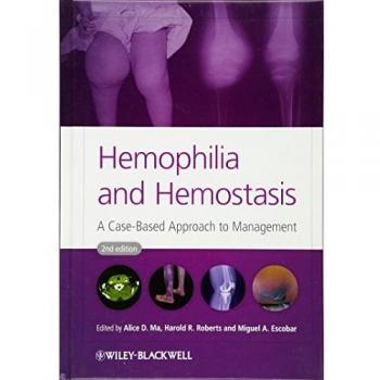 Hemophilia and Hemostasis: Comprehensive Guide by A Ma (Hardcover Edition)
